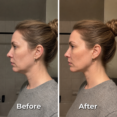 Sondelle Lymphatic Face Brush